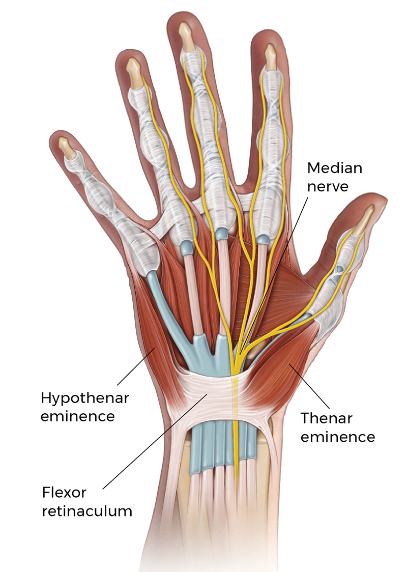 MA21_TheCarpalTunnel1 MA21_TheCarpalTunnel1