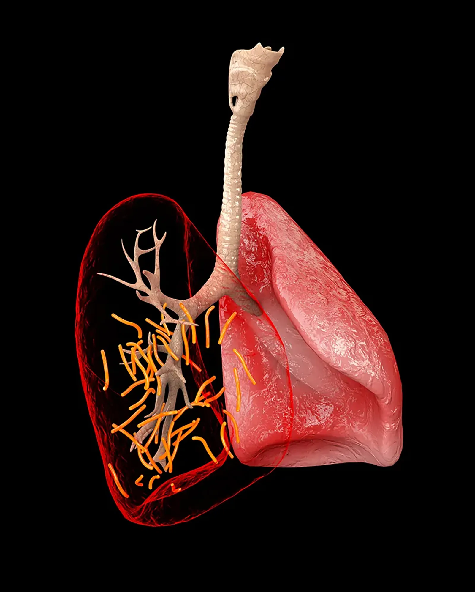 MJ21_PulmonaryFibrosis_Main