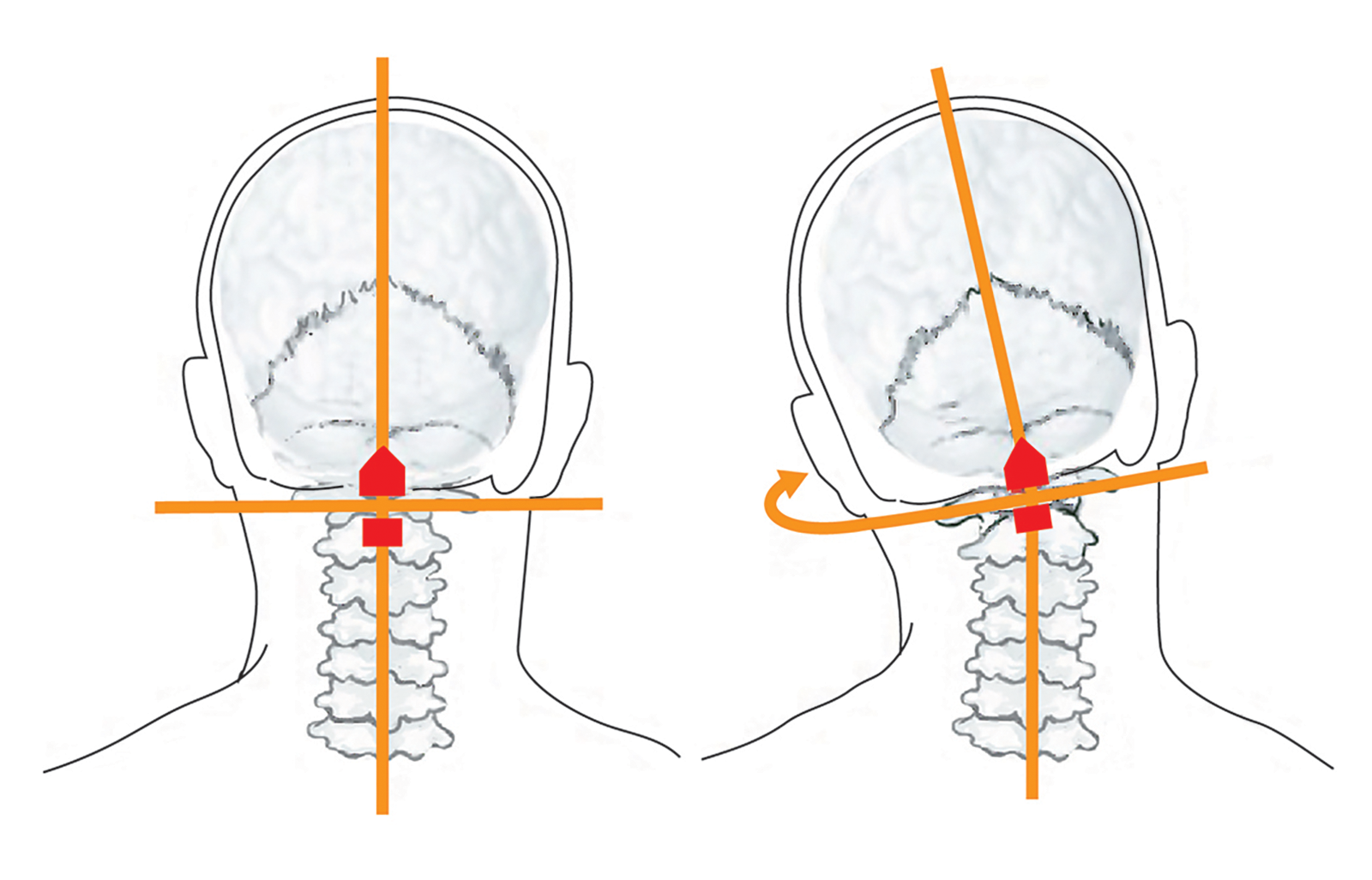 JF_15_Myoskeletal2_1600 JF_15_Myoskeletal2_1600