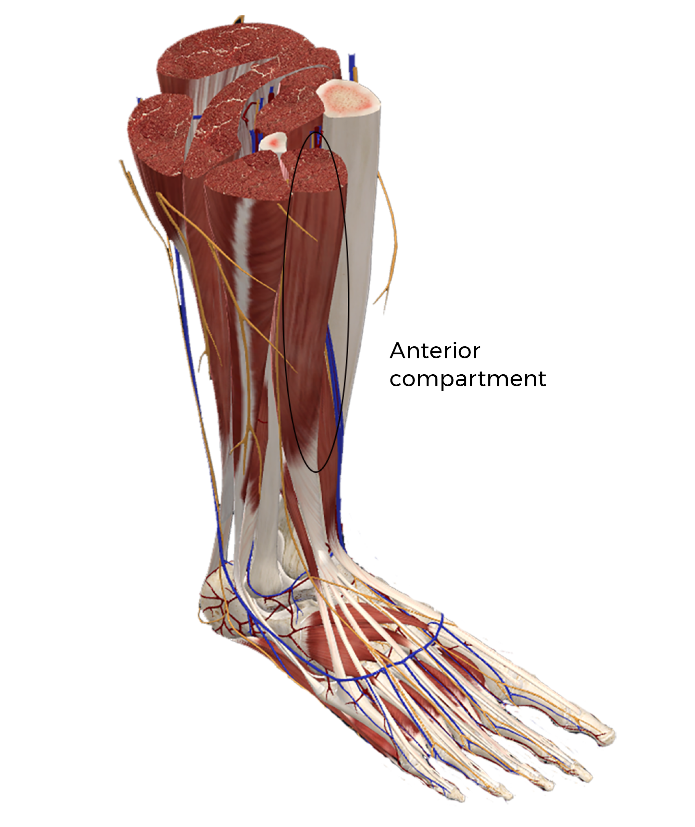 MA21_PuttingtheSqueeze2 MA21_PuttingtheSqueeze2