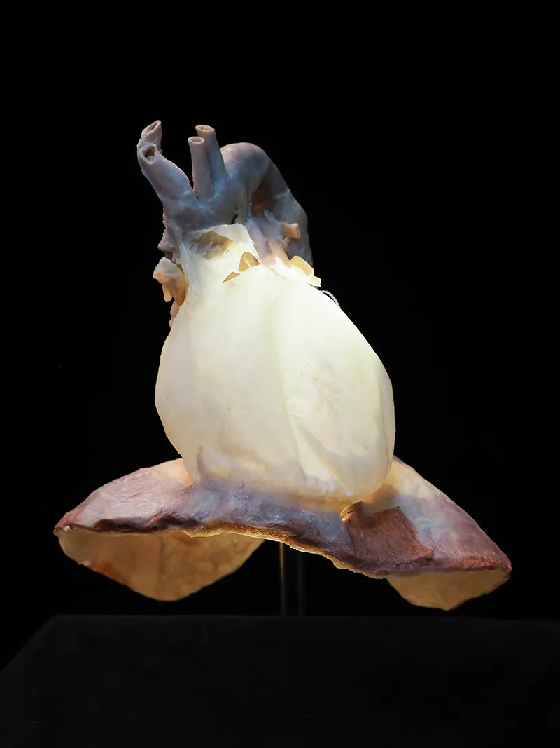 AUT_26_AnatomyTouch2_©FascialNetPlastinationProject_800 AUT_26_AnatomyTouch2_©FascialNetPlastinationProject_800