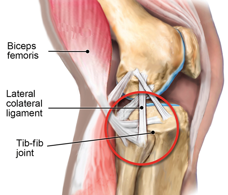 MJ20_Superior TibFib MJ20_Superior TibFib