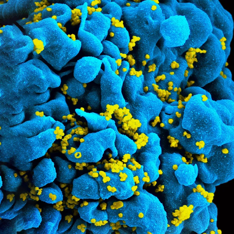 HIV AIDS Truths2 HIV AIDS Truths2
