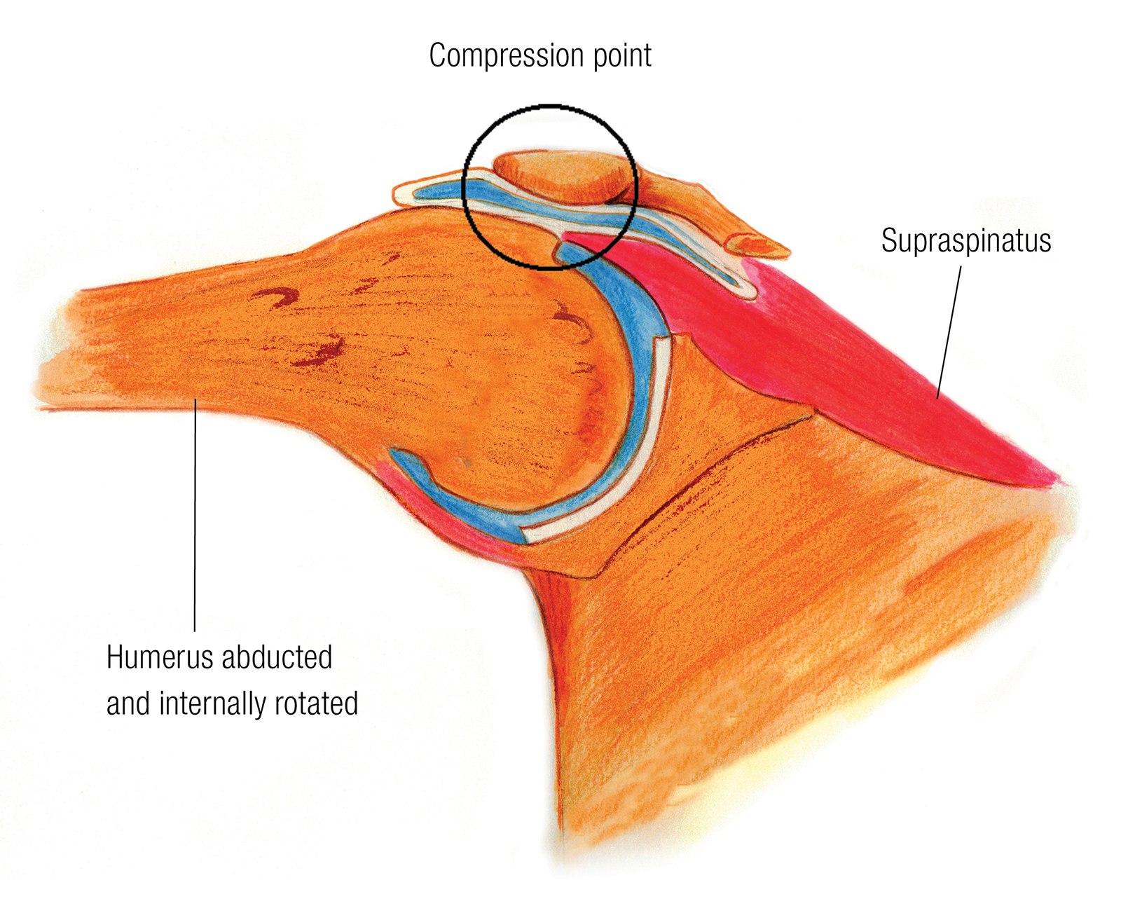 SO_16_PecMinor_CompressionPoint_1600