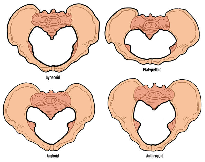 JF21_ResolvingWounds_Pelvis1
