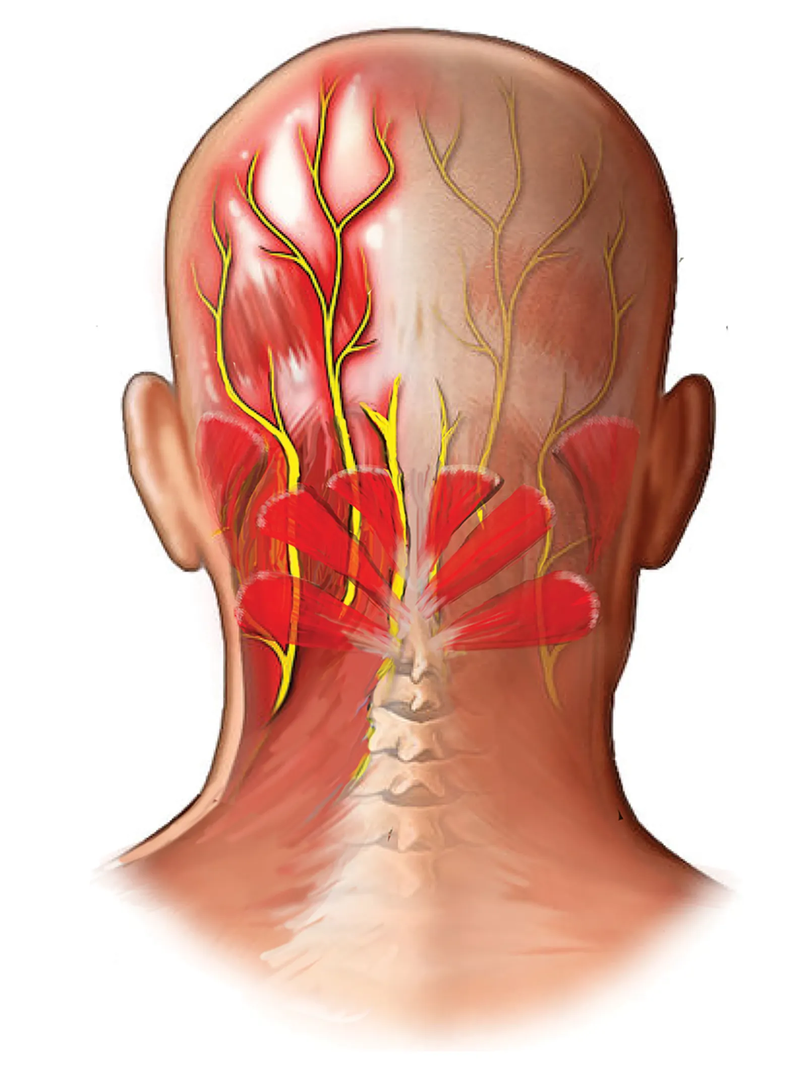 JA_14_Myoskeletal2_1600 JA_14_Myoskeletal2_1600
