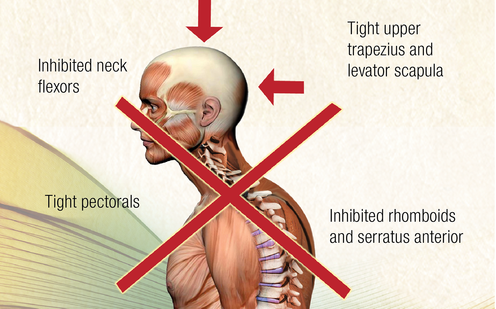 JF_15_Myoskeletal6_1600 JF_15_Myoskeletal6_1600