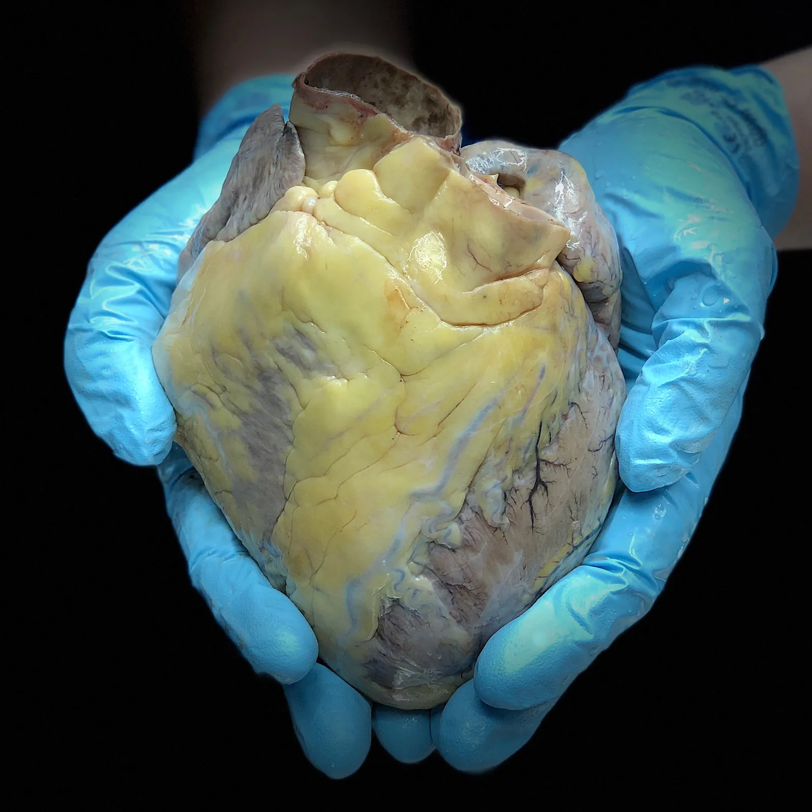 SO_18_HumanFascialPlastinationProject1_1600