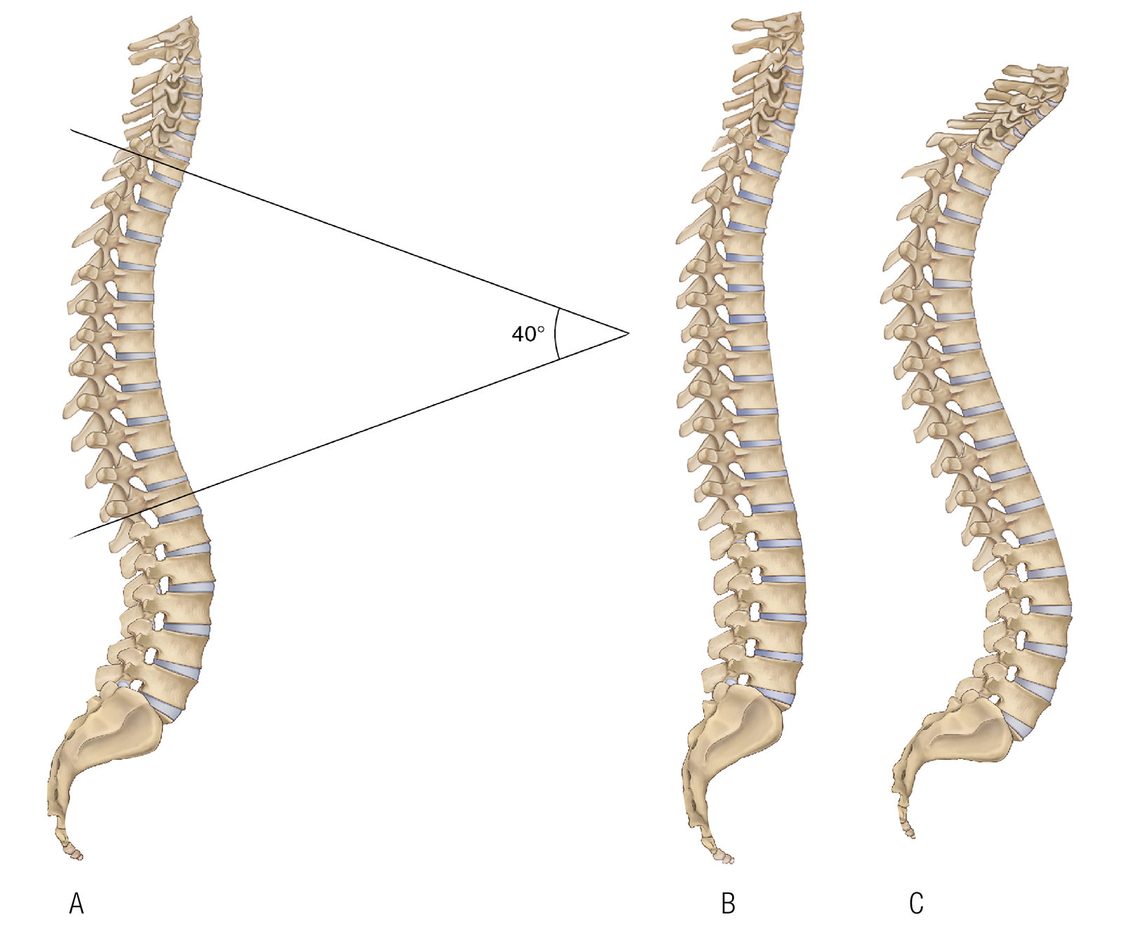 JA_16_ThoracicSpine1_ABC_1600 JA_16_ThoracicSpine1_ABC_1600
