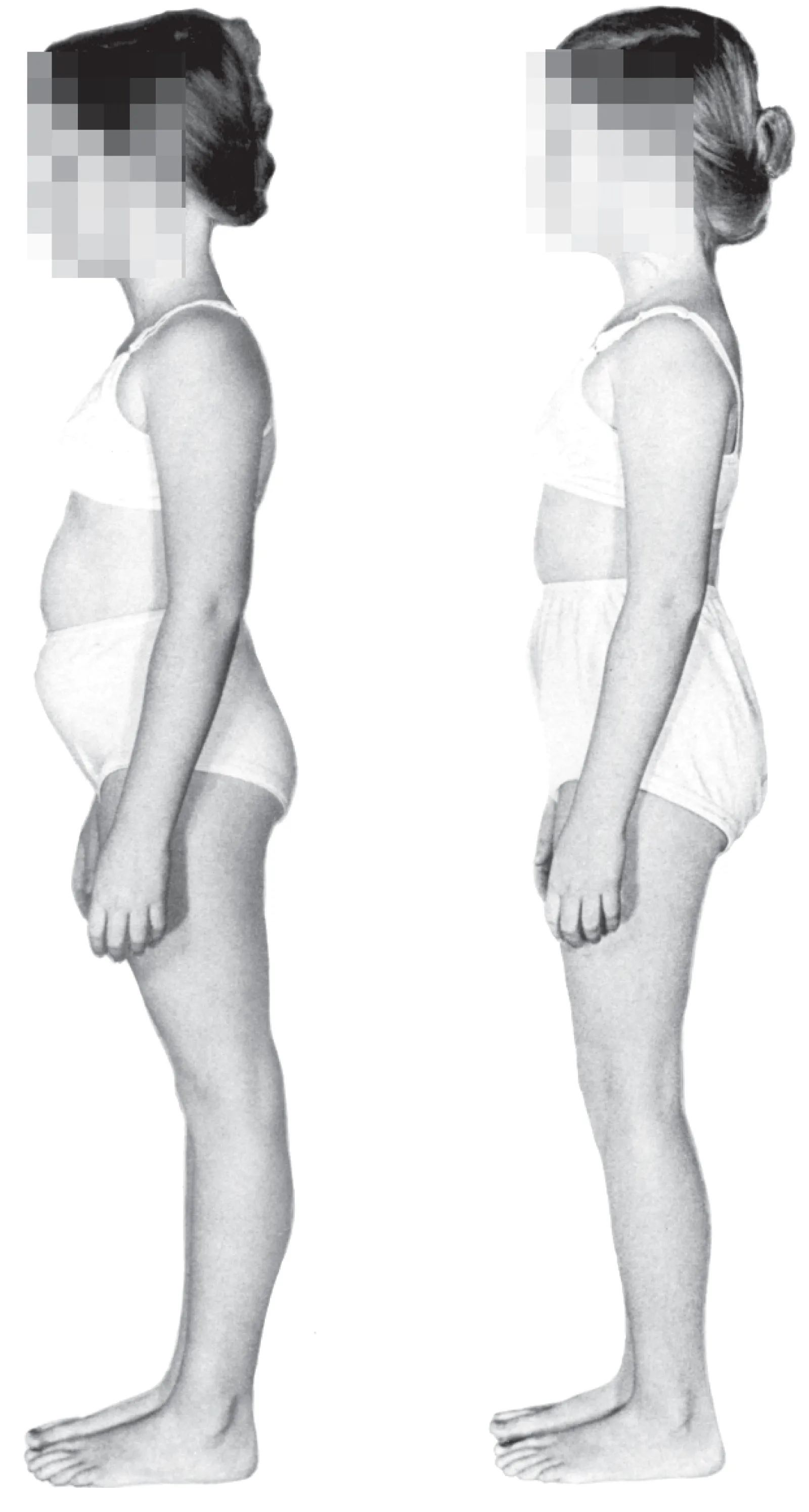 SO_16_UnderstandingFascia_MyStory_Posture SO_16_UnderstandingFascia_MyStory_Posture