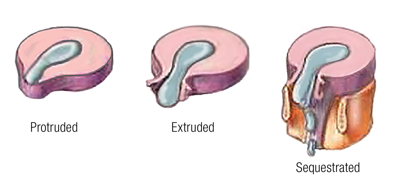 ND16_Myoskeletal2 ND16_Myoskeletal2