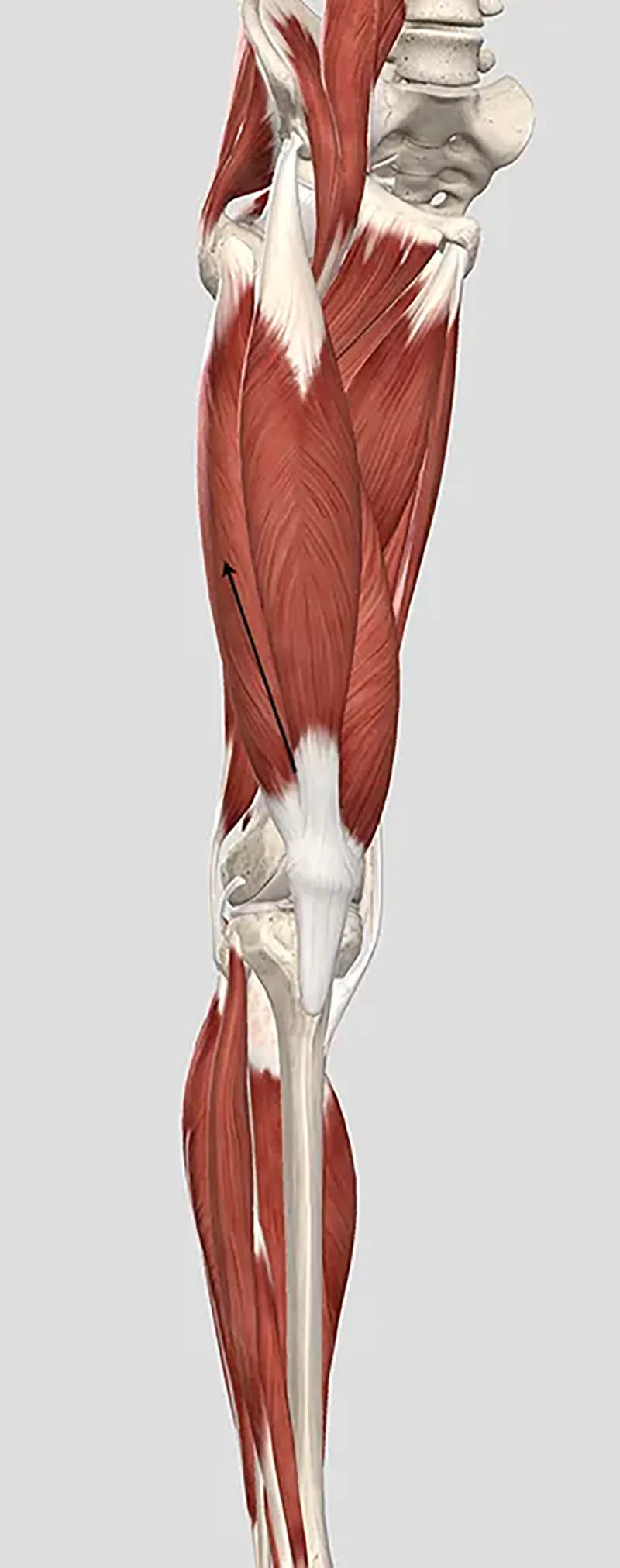 JA20_Grind Patellae3 JA20_Grind Patellae3