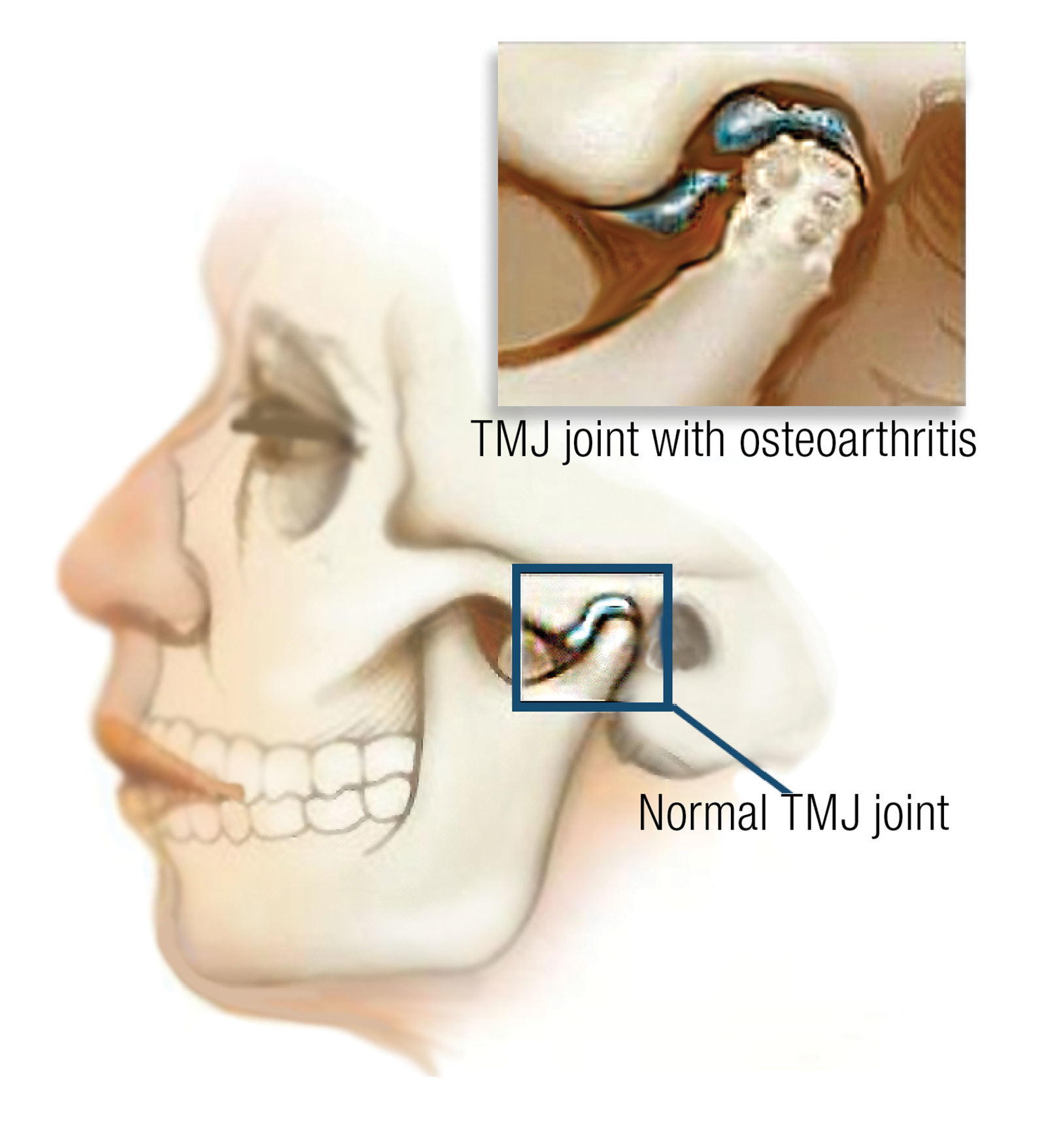JF_15_Myoskeletal1_1600 JF_15_Myoskeletal1_1600