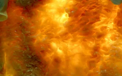 A cellular look at squidgy, superficial fascia.