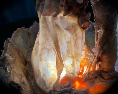 A plastinate model of, what looks like, near-real human pericardium.