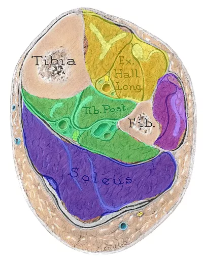 cross section slice of fibula, tibia, and 4 compartments in lower leg bones.