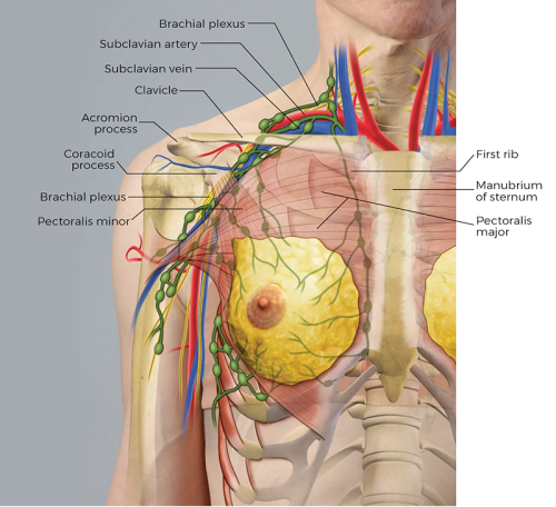 the thoracic outlet area, brachial plexus, clavicle, pectoralis areas all labeled.