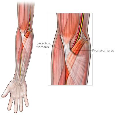 The lacertus fibrosus and pronator teres are highlighted.