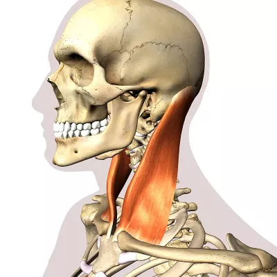 lateral view of the SCM muscle on a skeletal diagram.