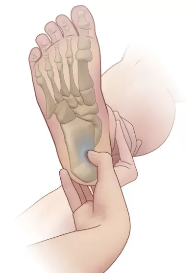 palpating the tarsal tunnel at the bottom of the foot.