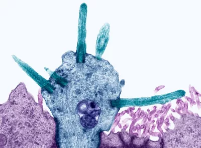 An olfactory receptor cell under an electron micrograph.