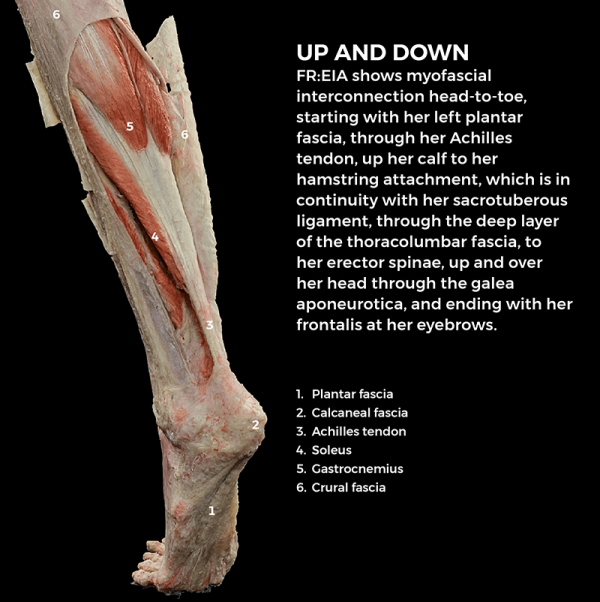 Leg and ankle portion of FREIA showing myofascial interconnection in plantar fascia.