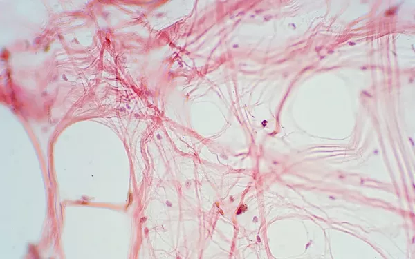 A histological image of loose connective tissue showing many fibroblasts.