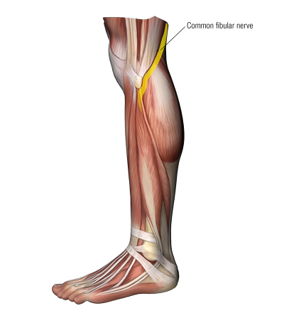 lateral view of the common fibular nerve in the leg.
