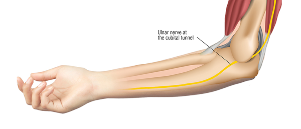 the ulnar nerve in the cubital tunnel in the forearm.