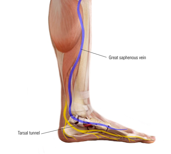 the great saphenous vein and the tarsal tunnel in the foot, lateral view.
