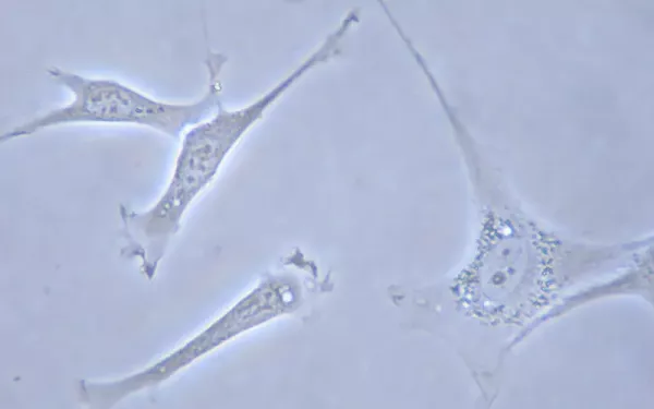 Microscopic picture of the fibroblast.