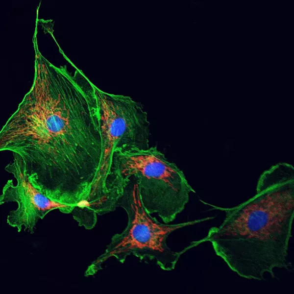 A fluorescent confocal microscopy image showing the inside of a cell.
