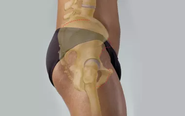 lateral view of the coxal joint at the head of the femur.