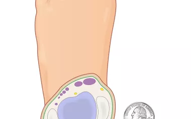 The tibiotalar joint in the foot, shown as a slice.
