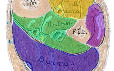 cross-section of the lower leg showing the tibia, fibula, and four compartments.