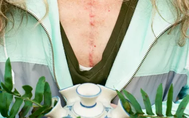 A woman with a scar on her chest holds a plant.