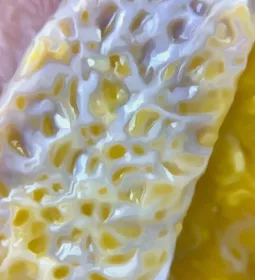 Superficial and deep sides of the skin