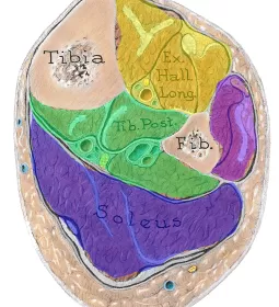 cross-section of the lower leg showing the tibia, fibula, and four compartments.
