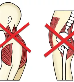 an &quot;x&quot; at the upper body and an &quot;x&quot; at the lower back demonstrating a criss-cross syndrome.
