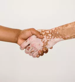 Two outstretched arms shake hands.