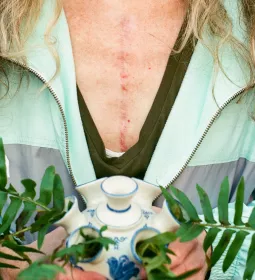 A woman with a scar on her chest holds a plant.