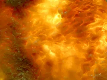 Human plastinate model of muscle and lung tissue.