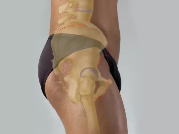 lateral view of the coxal joint at the head of the femur.