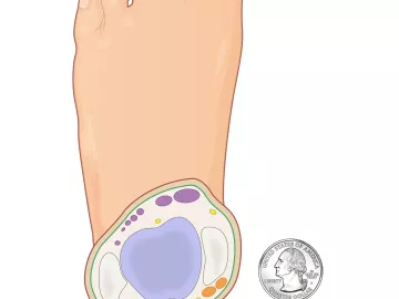 The tibiotalar joint in the foot, shown as a slice.