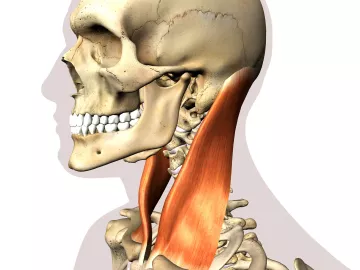 sternocleidomastoid (SCM) muscle in the neck.