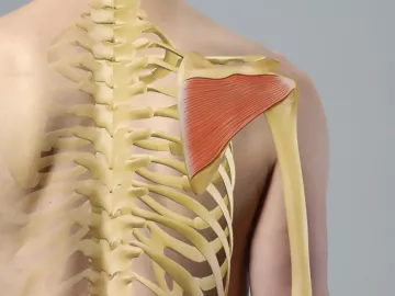 anatomical label showing infraspinatus muscle in the shoulder area.