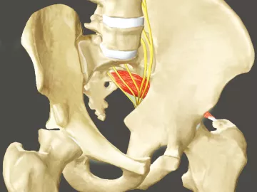 Sciatic nerve on a pelvic anatomical diagram.