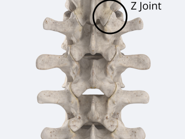 The z joint in the lumbar region accounts for low back pain.