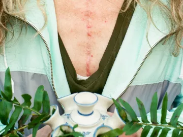 A woman with a scar on her chest holds a plant.