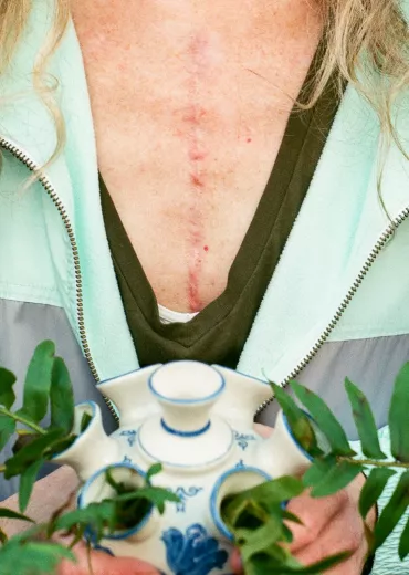 A woman with a scar on her chest holds a plant.